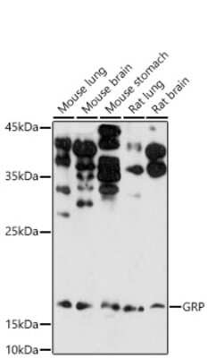 Western Blot: Gastrin-releasing Peptide/Bombesin/Neuromedin C AntibodyBSA Free [NBP3-03282]